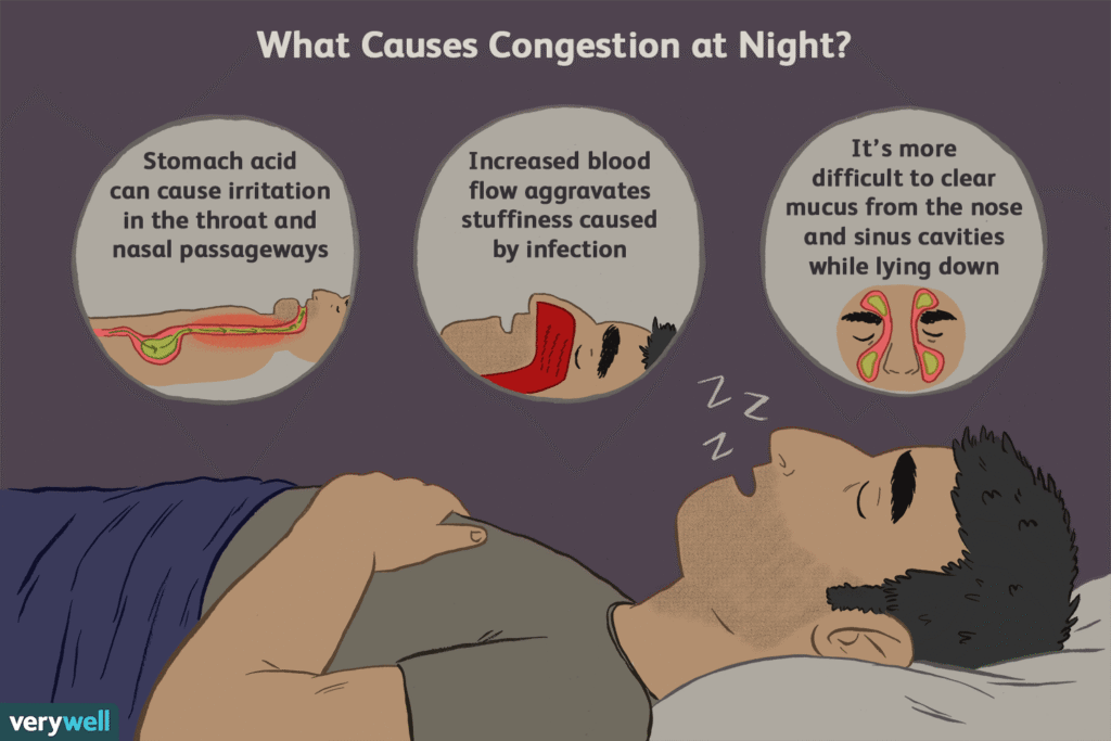 How To Sleep With Sinus Pressure