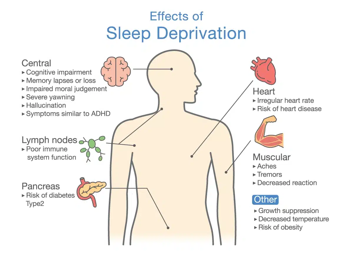 Sleep Deprivation Symptoms