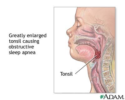 Disadvantages Of Sleeping On Your Back