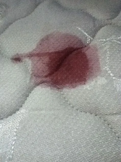 How to Clean Period Blood From a Mattress