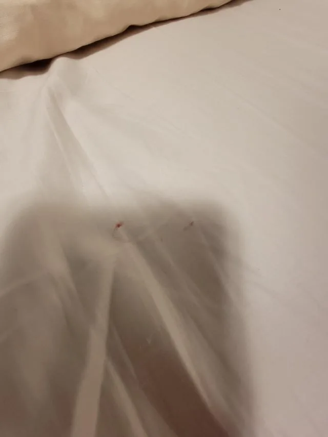 Mattress blotting technique